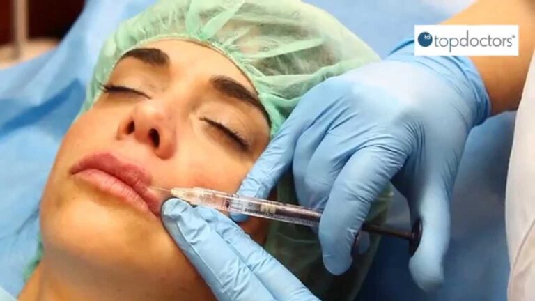 Tipos de Rellenos para Labios: Gu&iacute;a Completa y Opciones Disponibles