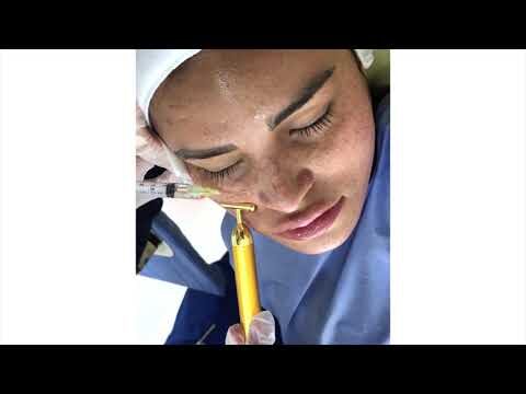 Precios de Mesoterapia Facial para Tratar Manchas en la Piel