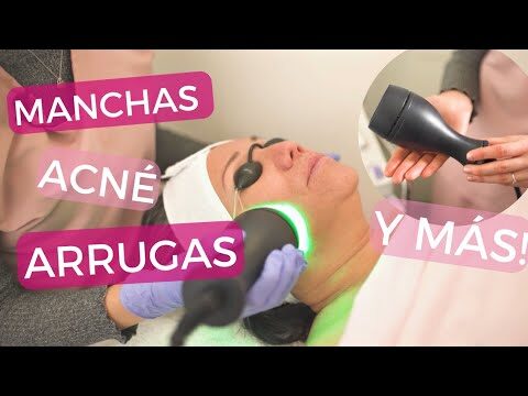 Ventajas del L&aacute;ser en Tratamientos Faciales