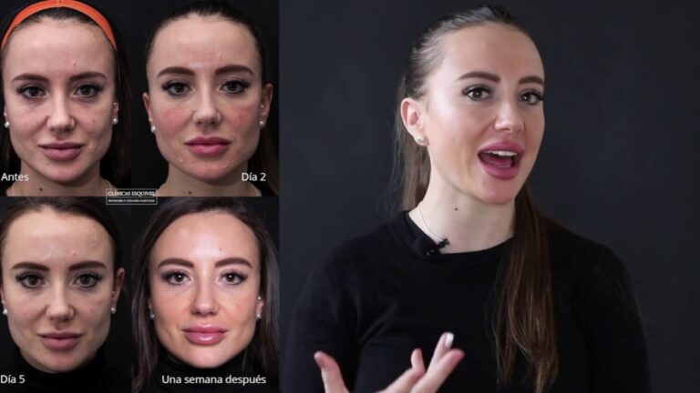 Gu&iacute;a para Reservar Peeling Qu&iacute;mico en Cl&iacute;nica Est&eacute;tica