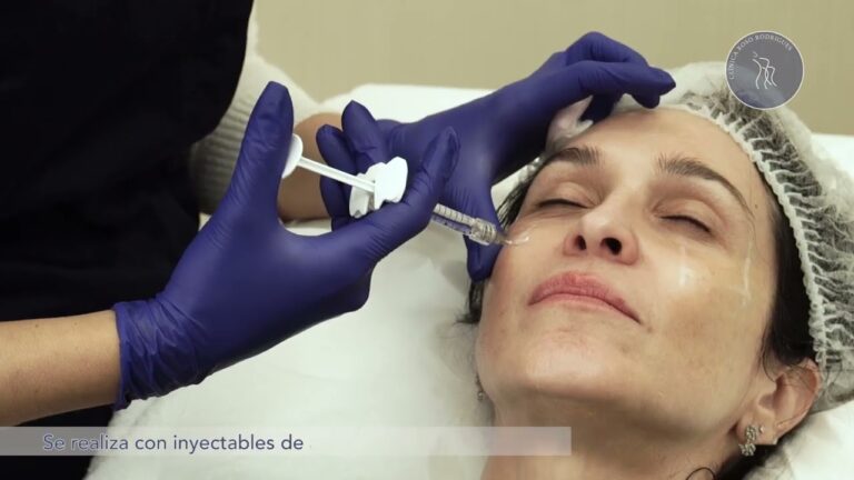 Rellenos D&eacute;rmicos: Opiniones y Beneficios para la Voluminizaci&oacute;n Facial