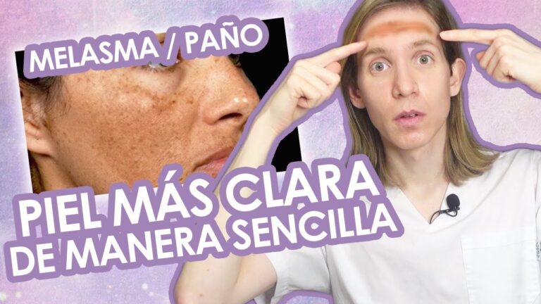 Guía Esencial para el Uso de Cremas Despigmentantes