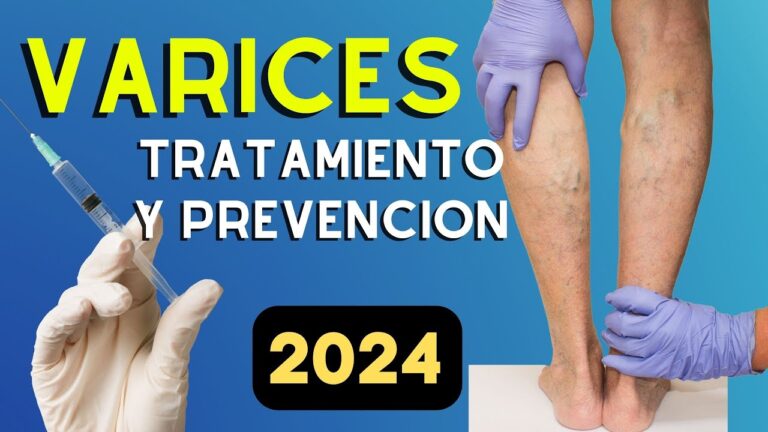 Resultados Efectivos del Tratamiento de Varices con Medicina Est&eacute;tica