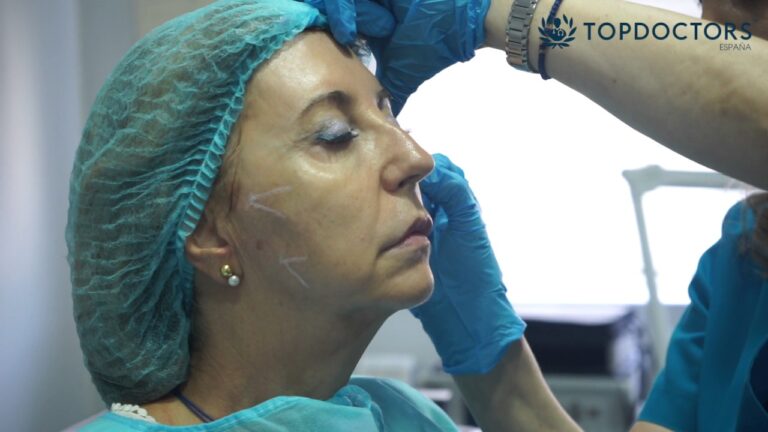 Rejuvenecimiento Facial Sin Cirug&iacute;a: Opciones Efectivas