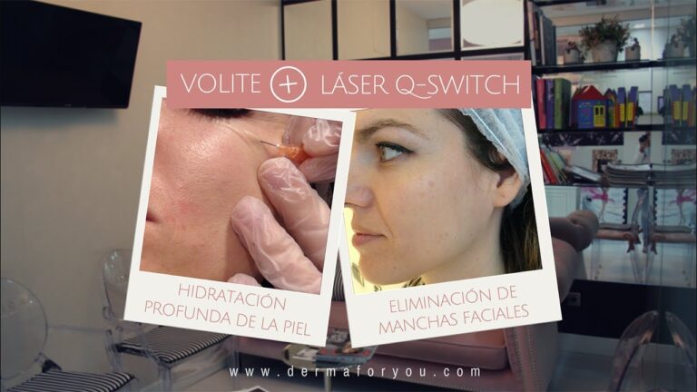 Duraci&oacute;n de Resultados en Mesoterapia Facial Est&eacute;tica
