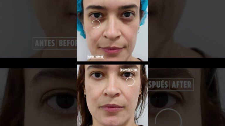 Eficacia de los Paquetes de Tratamiento en Medicina Est&eacute;tica