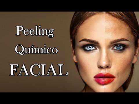 Precios de Peelings Qu&iacute;micos en Cl&iacute;nicas Est&eacute;ticas: Gu&iacute;a y Comparativa