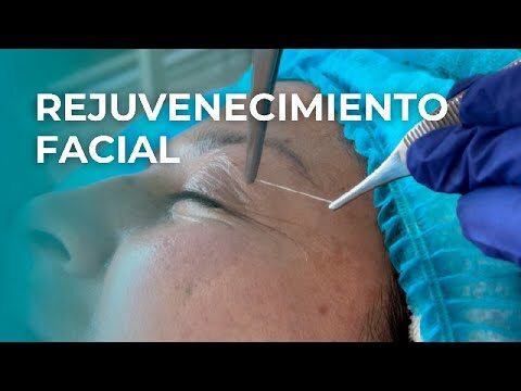 Precios de Tratamientos Antiarrugas en Cl&iacute;nicas: Gu&iacute;a y Comparativa