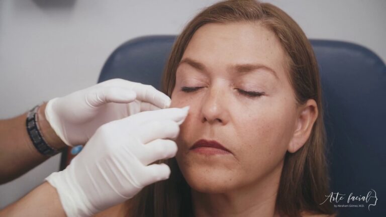 Opiniones de Pacientes sobre Tratamientos para Ojeras