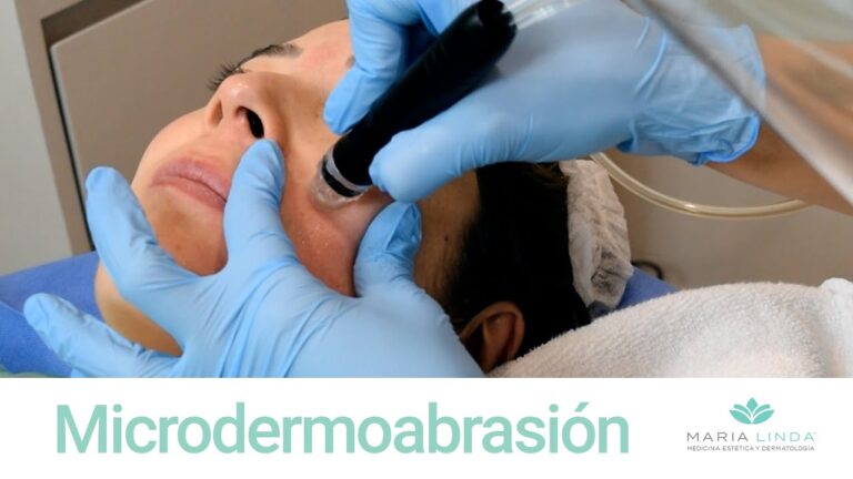 Beneficios Clave de la Microdermoabrasi&oacute;n Facial