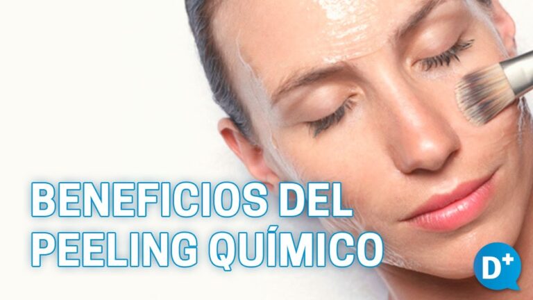 Beneficios de los Peelings Qu&iacute;micos para la Piel