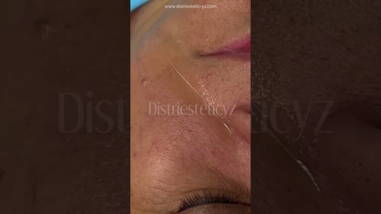 Opciones Efectivas de Pago para la Compra de Hilos Tensores Est&eacute;ticos