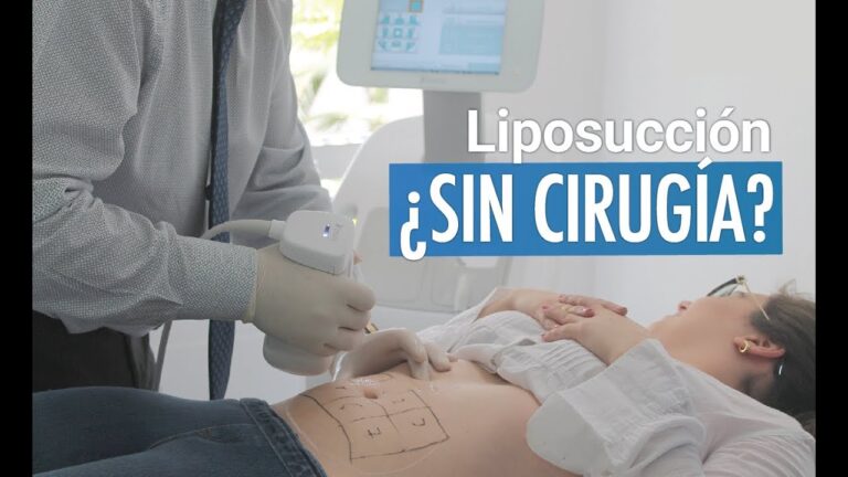 Costos de Tratamientos de Liposucci&oacute;n No Invasiva: Lo que Debes Saber
