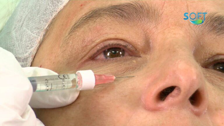 Gu&iacute;a de Precios de Mesoterapia Facial en Tu &Aacute;rea