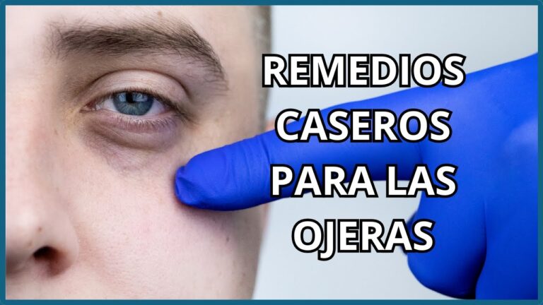 M&eacute;todos Naturales para Eliminar Ojeras de Manera Efectiva